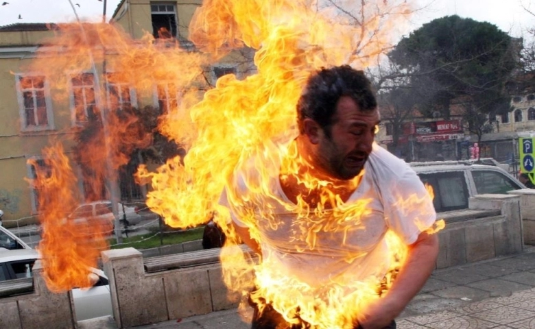 O 'dehşet fotoğraf'taki kişi konuştu: "Ateşe yaklaşamıyorum"