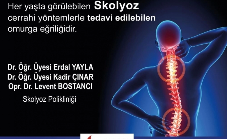 Bölgedeki ilk ve tek skolyoz polikliniği hizmete açıldı