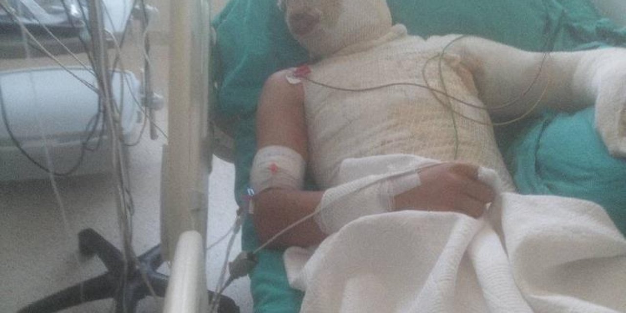 Miras anlaşmazlığı yüzünden amca yeğenini yaktı