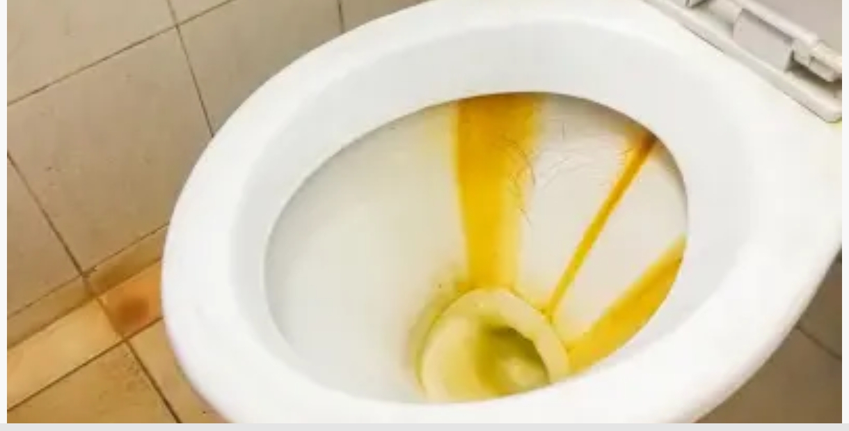 Sararan tuvalet taşlarını beyazlatan doğal formüller!
