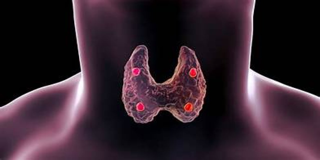 Prof. Dr. Maralcan: "Tiroit kanserlerinin tipik bir belirtisi yoktur"