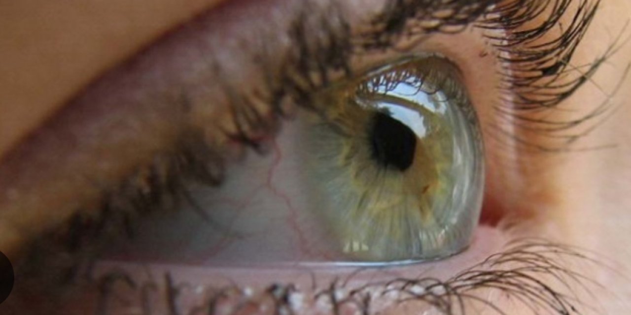 Göz alerjisi göz kuruluğuna yol açabilir