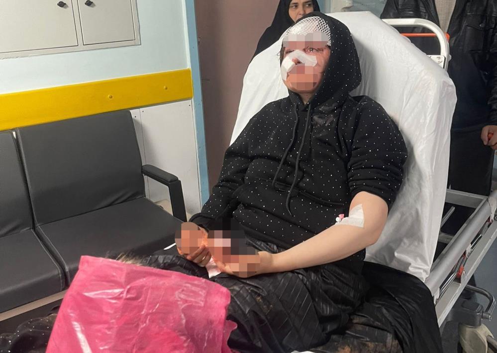 Gaziantep'te dehşet veren olay: boşanmak isteyen eşini öldüresiye dövdü