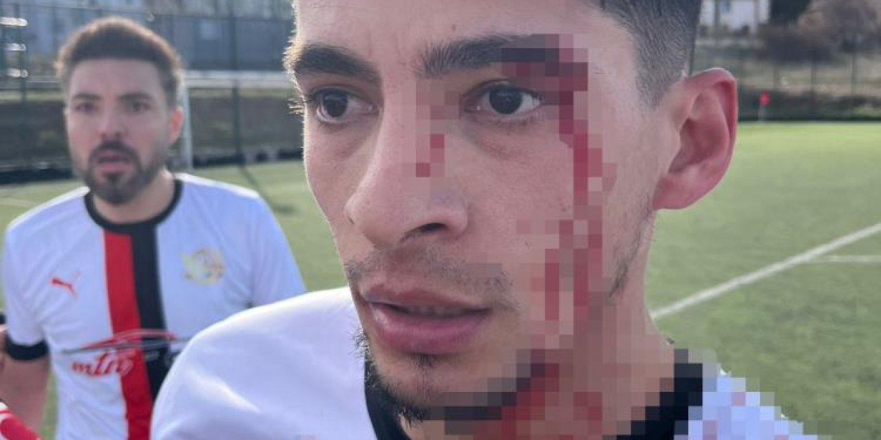 Sahada yumruklar konuştu: 3 futbolcu hastanelik oldu