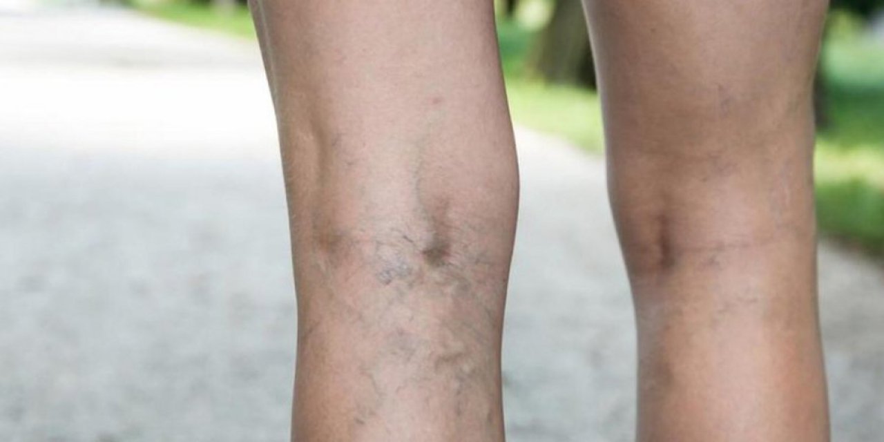 Varis vakalarında alarm! Op. Dr. Ercan Servet’ten kritik uyarı