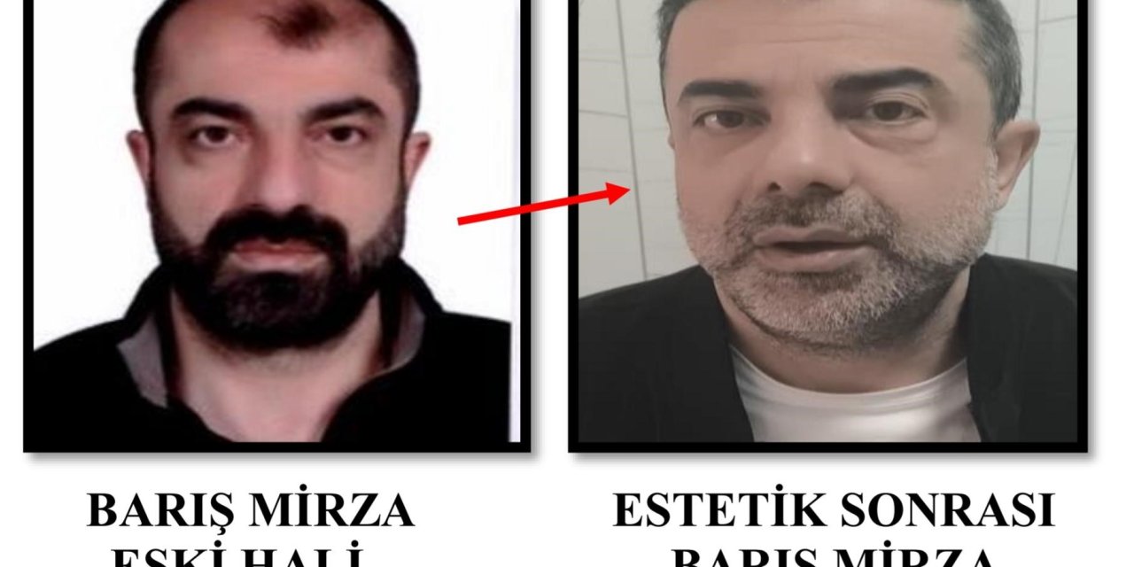 Ameliyat ile yüzünü değiştiren cinayet zanlısı, 7 yıl sonra yakalandı