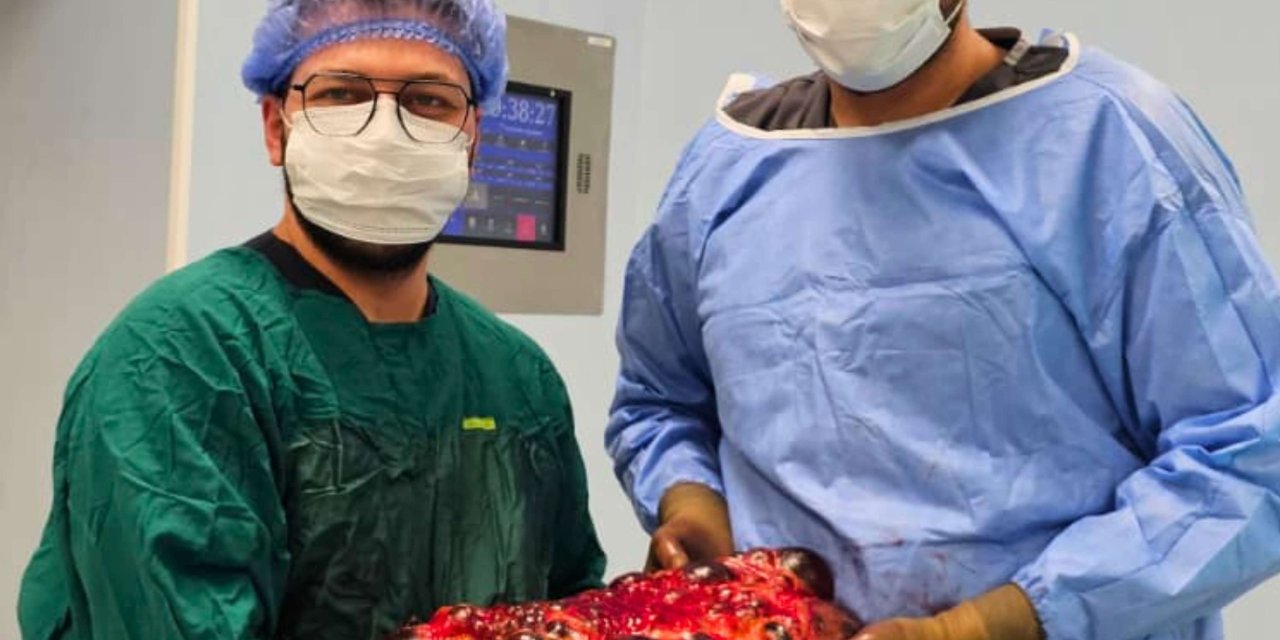 Şehir Hastanesinde 8,5 kiloluk böbrek 30 dakikada alındı