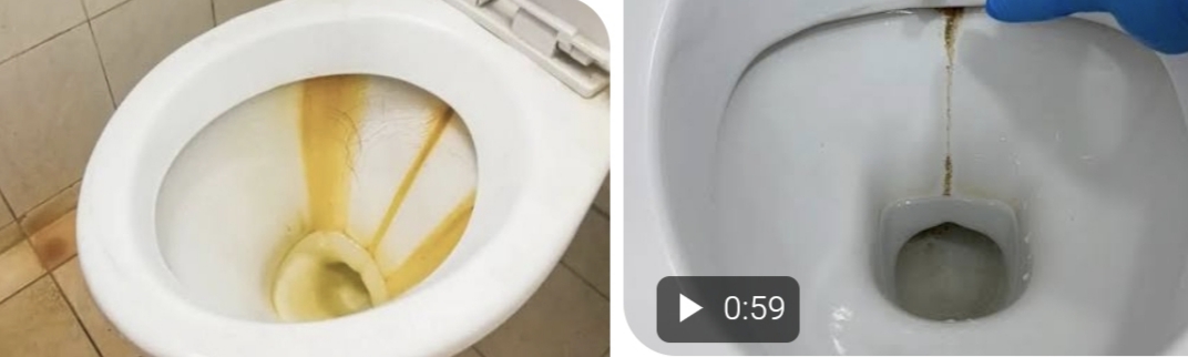 Klozet lekelerini çıkarmak için pratik çözüm
