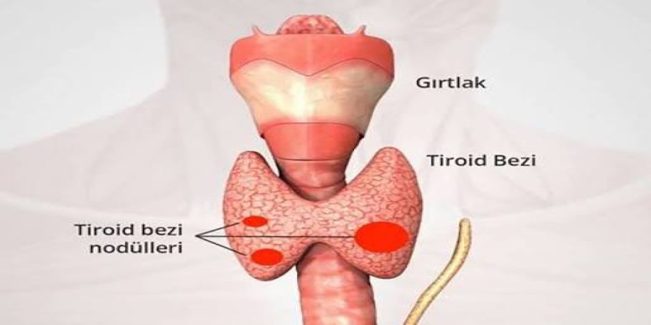 Uzmandan dikkat çeken açıklama; Tiroid kanseri belirti vermeden ilerliyor